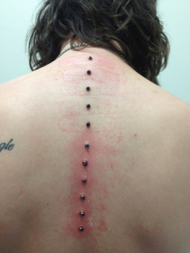 Pierderea microdermică: cum se fac microdermabrele (foto)