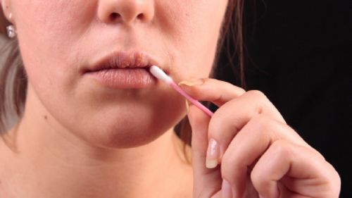 Căi eficiente pentru a trata rănile pe buze