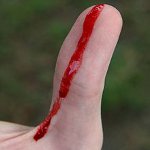 Primul ajutor pentru sângerare Primul ajutor pentru sângerare