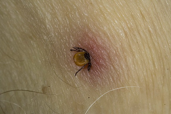 Mâncări de insecte